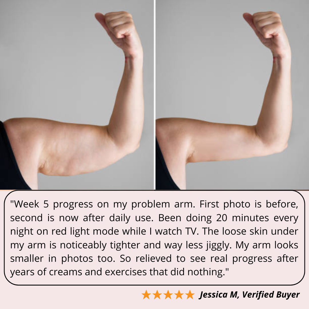 CellActive™ Red Light Arm Toner